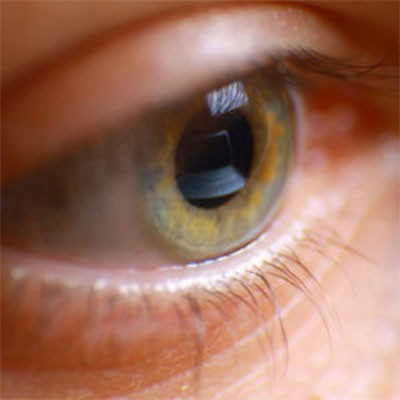 ایا هایفوتراپی چشم با درد همراه است؟